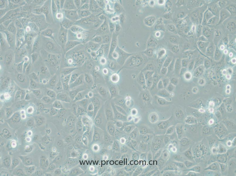 COLO-680N (人食管鱗狀細(xì)胞癌) (STR鑒定正確)