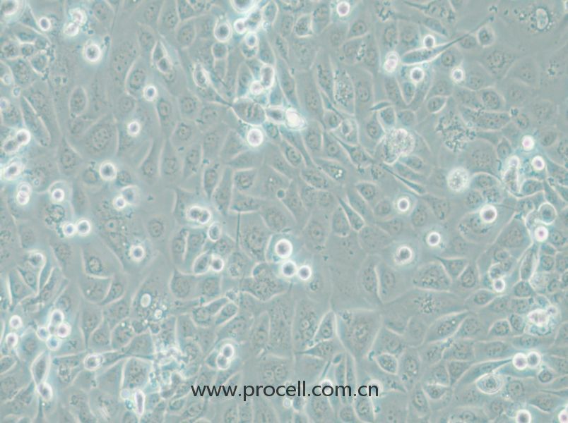 COLO-680N (人食管鱗狀細(xì)胞癌) (STR鑒定正確)