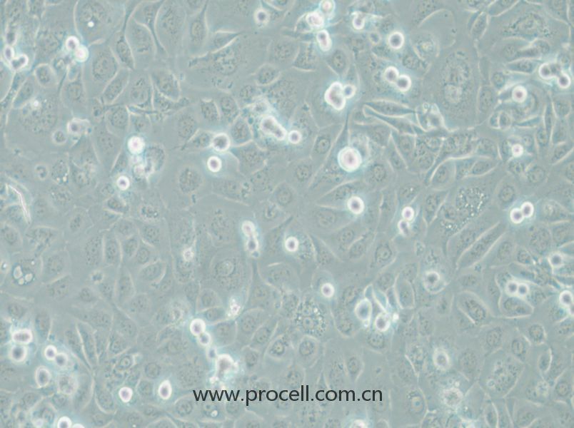 COLO-680N (人食管鱗狀細(xì)胞癌) (STR鑒定正確)