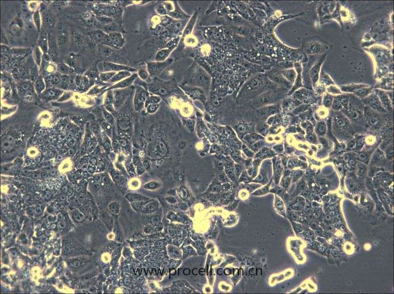 CL-11(人結(jié)腸癌細(xì)胞) (STR鑒定正確)