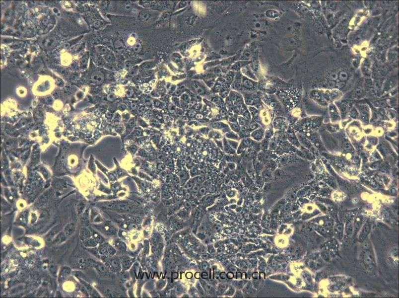 CL-11(人結(jié)腸癌細(xì)胞) (STR鑒定正確)