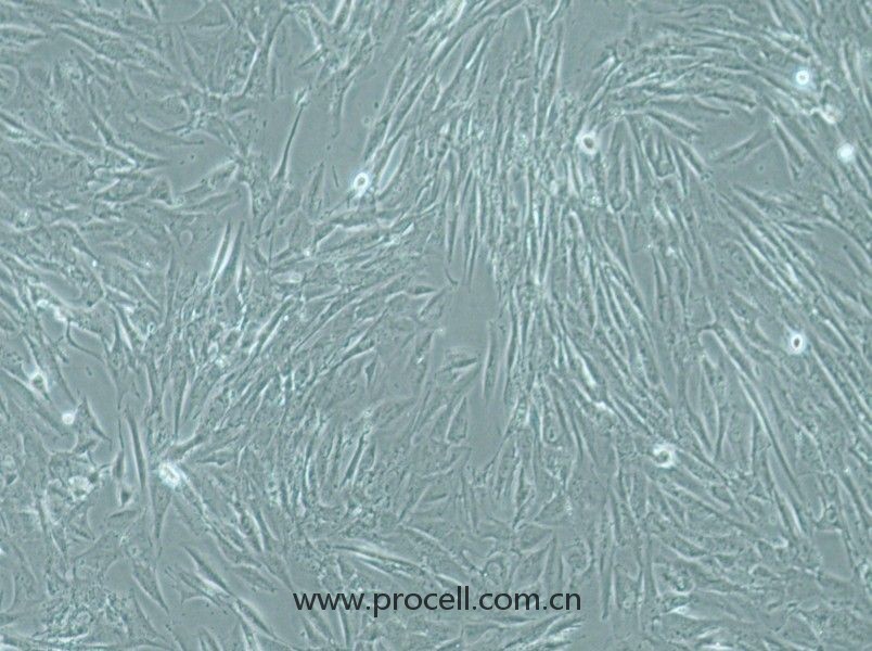 SW1088 (人腦星形膠質瘤細胞) (STR鑒定正確)