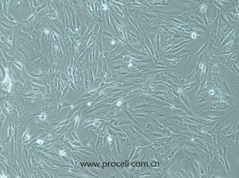 SW1088 (人腦星形膠質(zhì)瘤細(xì)胞) (STR鑒定正確)