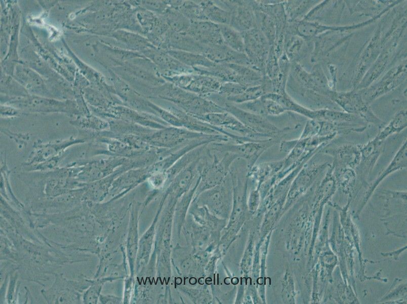 SW1088 (人腦星形膠質(zhì)瘤細(xì)胞) (STR鑒定正確)