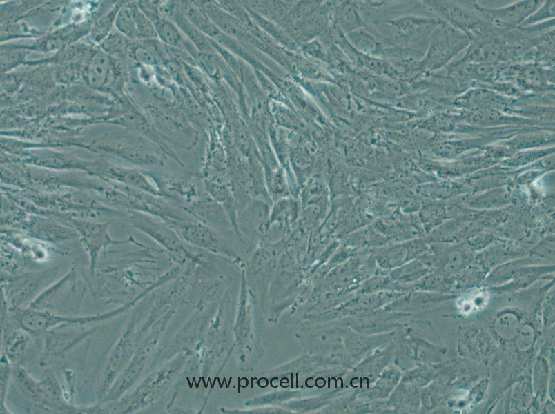 SW1088 (人腦星形膠質(zhì)瘤細(xì)胞) (STR鑒定正確)