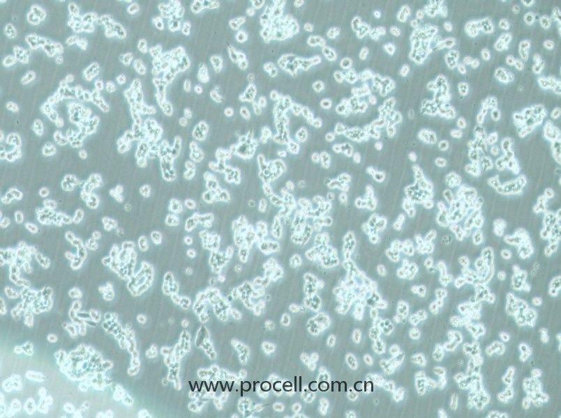 alpha TC1 clone 6 (小鼠胰腺α細(xì)胞) (STR鑒定正確)