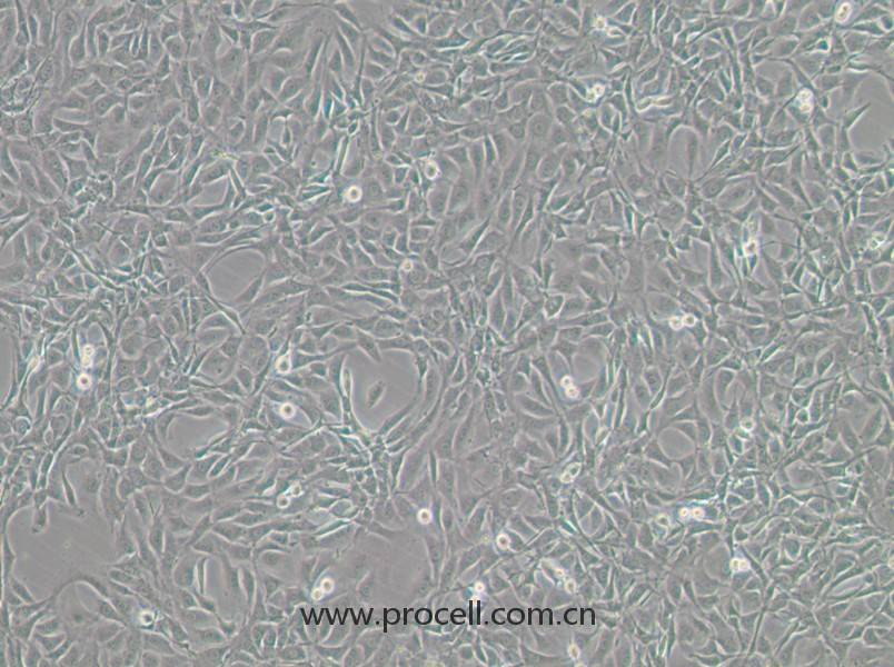 NIH/3T3-GFP（小鼠胚胎細(xì)胞（綠色熒光標(biāo)記））(STR鑒定正確)