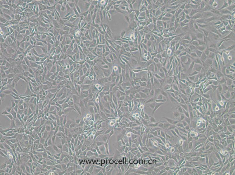 NIH/3T3-GFP（小鼠胚胎細(xì)胞（綠色熒光標(biāo)記））(STR鑒定正確)