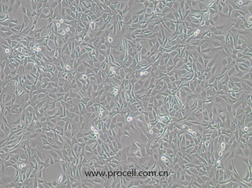 NIH/3T3-GFP（小鼠胚胎細(xì)胞（綠色熒光標(biāo)記））(STR鑒定正確)