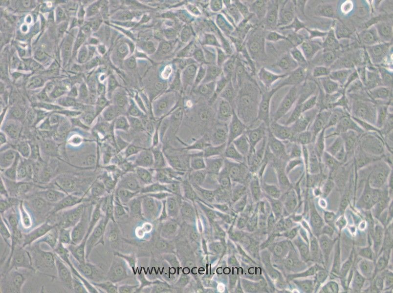 NIH/3T3-GFP（小鼠胚胎細(xì)胞（綠色熒光標(biāo)記））(STR鑒定正確)