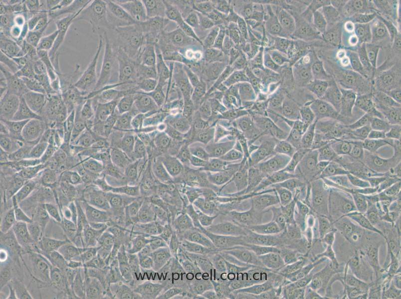 NIH/3T3-GFP（小鼠胚胎細(xì)胞（綠色熒光標(biāo)記））(STR鑒定正確)