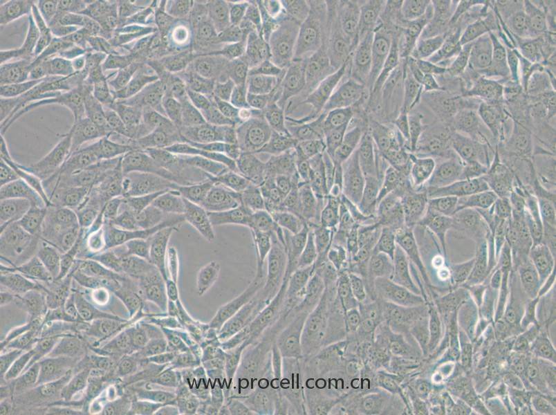 NIH/3T3-GFP（小鼠胚胎細(xì)胞（綠色熒光標(biāo)記））(STR鑒定正確)