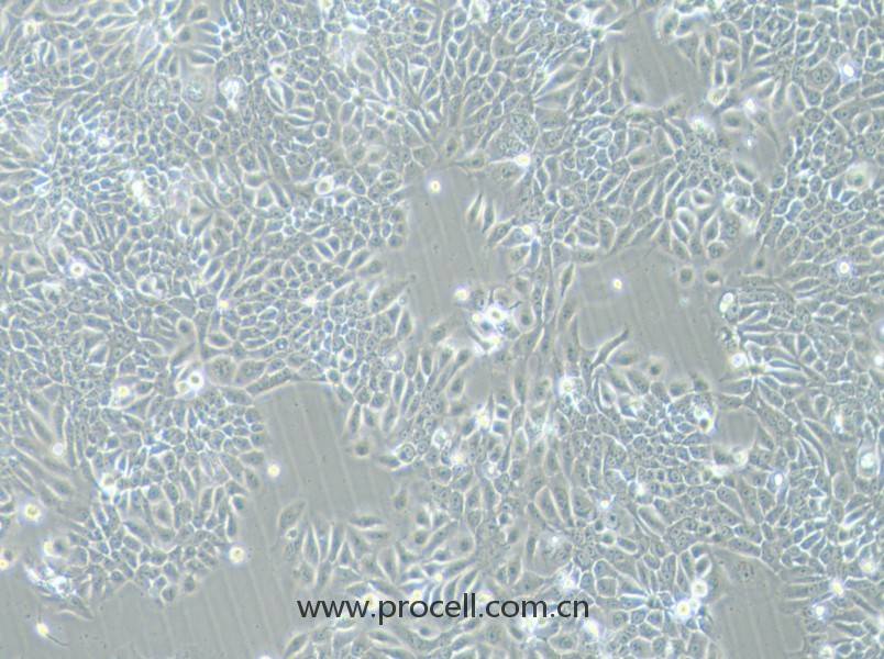 Eca-109 (人食管癌細(xì)胞) (STR鑒定正確)