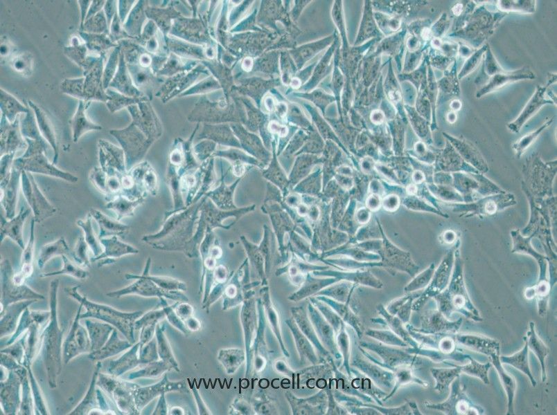 SK-MEL-5 (人皮膚黑色素瘤細(xì)胞) (STR鑒定正確)