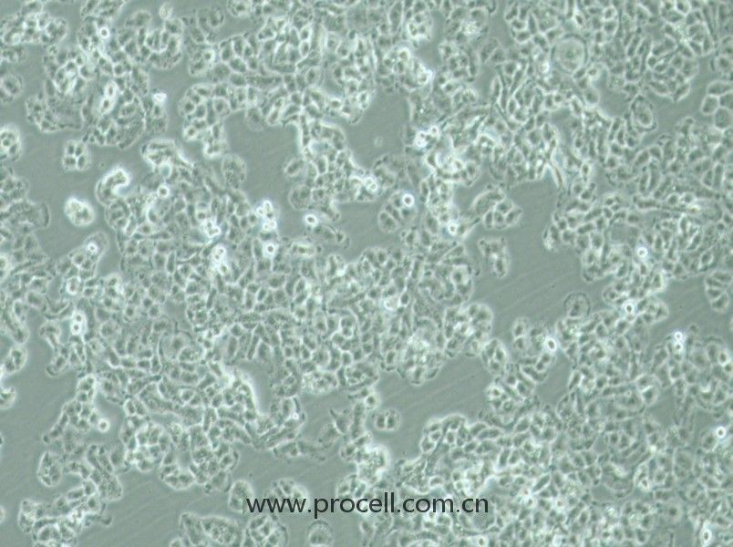 QGP-1 (人胰腺癌細胞) (STR鑒定正確)