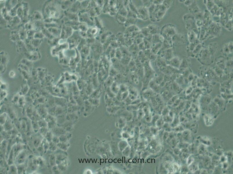 QGP-1 (人胰腺癌細胞) (STR鑒定正確)