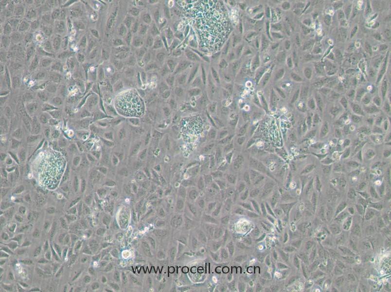 TR-LCC-1 (人喉癌細胞) (STR鑒定正確)