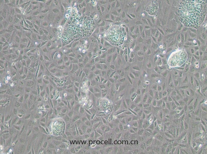 TR-LCC-1 (人喉癌細胞) (STR鑒定正確)