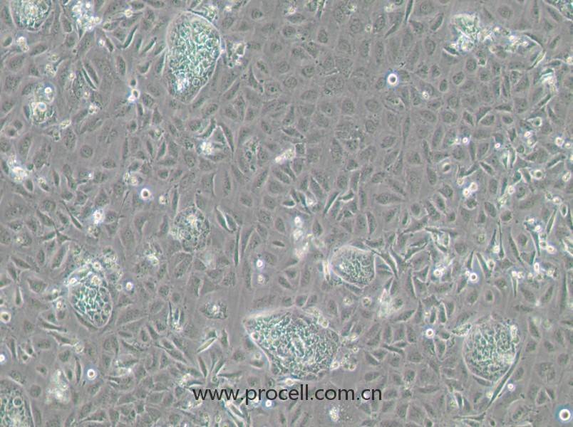 TR-LCC-1 (人喉癌細胞) (STR鑒定正確)