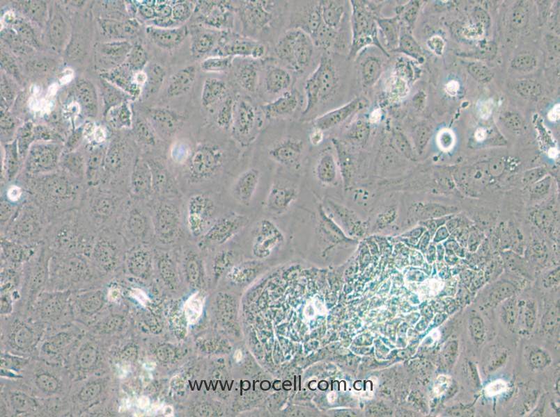 TR-LCC-1 (人喉癌細胞) (STR鑒定正確)