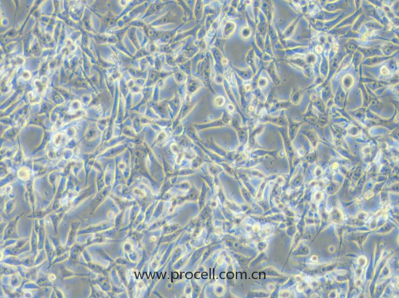 EBC-1 (人肺癌鱗癌細(xì)胞) (STR鑒定正確)