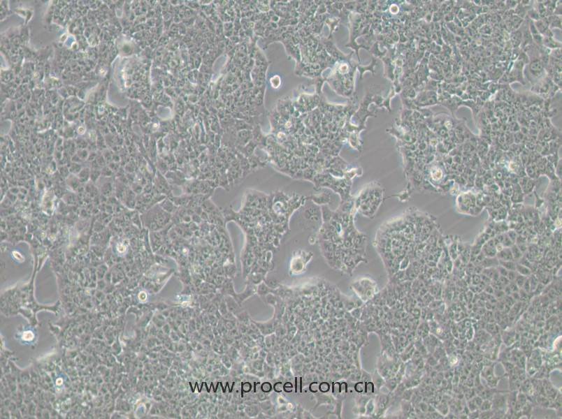 HePa1-6-GFP (小鼠肝癌細(xì)胞（綠色熒光標(biāo)記）) (STR鑒定正確)