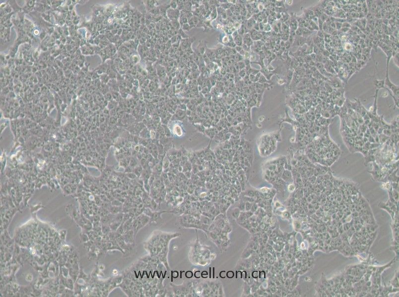 HePa1-6-GFP (小鼠肝癌細(xì)胞（綠色熒光標(biāo)記）) (STR鑒定正確)