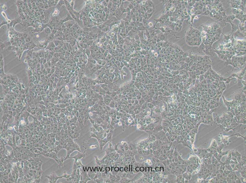 HePa1-6-GFP (小鼠肝癌細(xì)胞（綠色熒光標(biāo)記）) (STR鑒定正確)