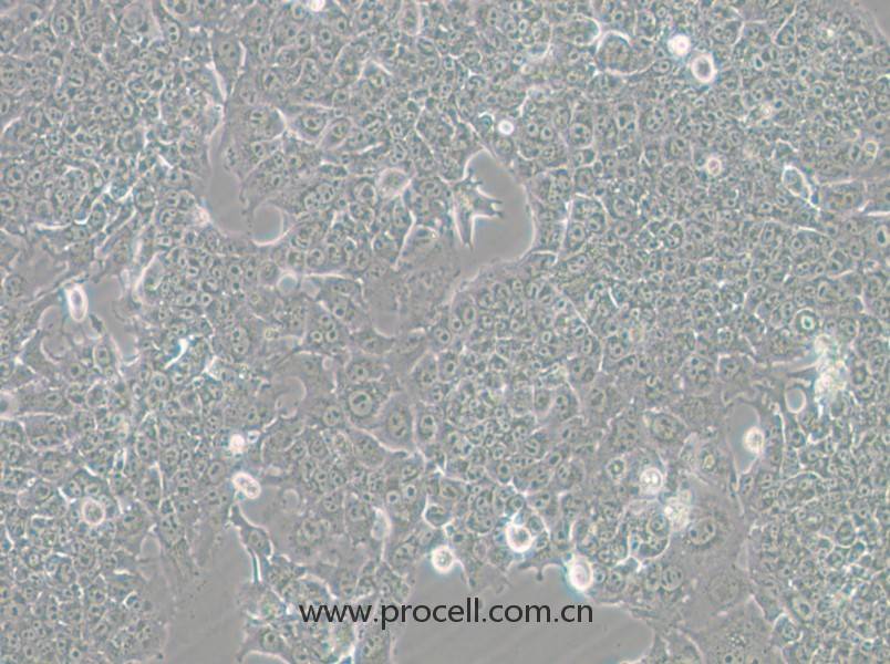 HePa1-6-GFP (小鼠肝癌細(xì)胞（綠色熒光標(biāo)記）) (STR鑒定正確)