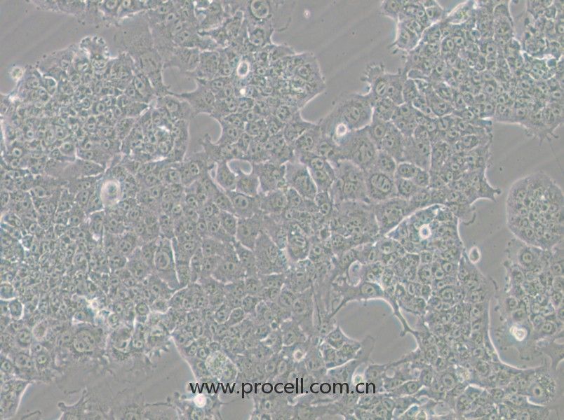 HePa1-6-GFP (小鼠肝癌細(xì)胞（綠色熒光標(biāo)記）) (STR鑒定正確)