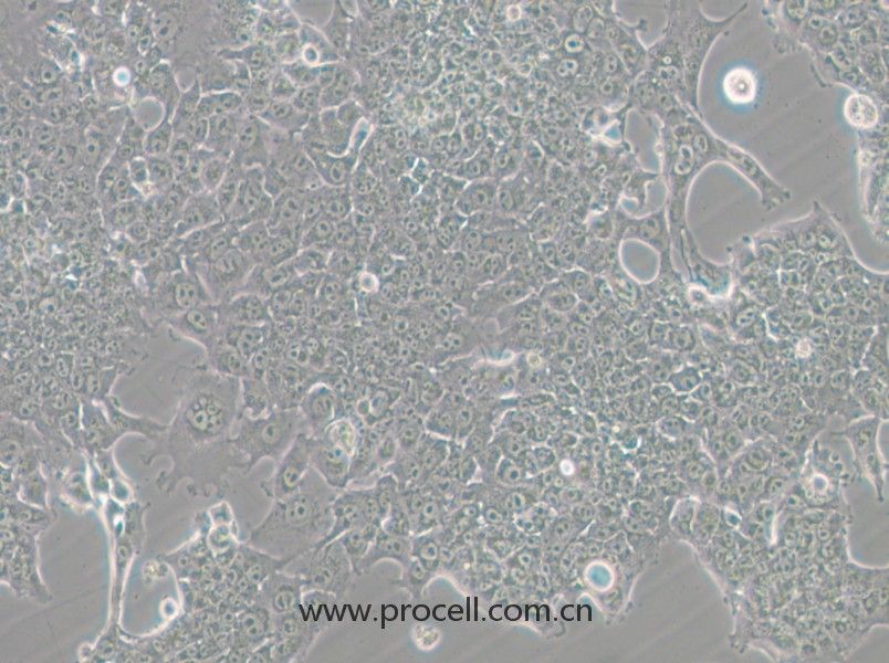 HePa1-6-GFP (小鼠肝癌細(xì)胞（綠色熒光標(biāo)記）) (STR鑒定正確)