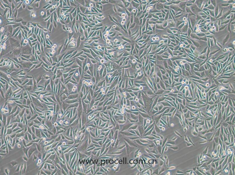 PC-3-GFP (人前列腺癌細(xì)胞（綠色熒光標(biāo)記）) (STR鑒定正確)