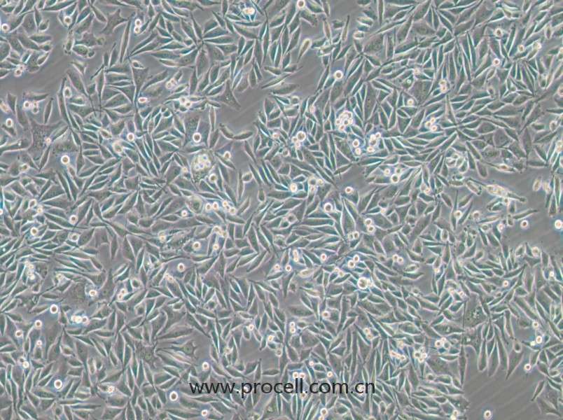 PC-3-GFP (人前列腺癌細(xì)胞（綠色熒光標(biāo)記）) (STR鑒定正確)