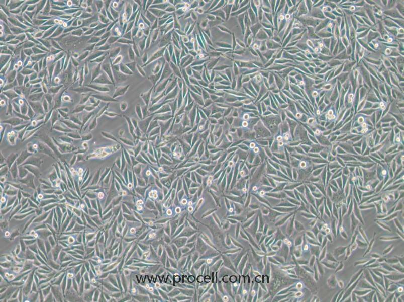 PC-3-GFP (人前列腺癌細(xì)胞（綠色熒光標(biāo)記）) (STR鑒定正確)