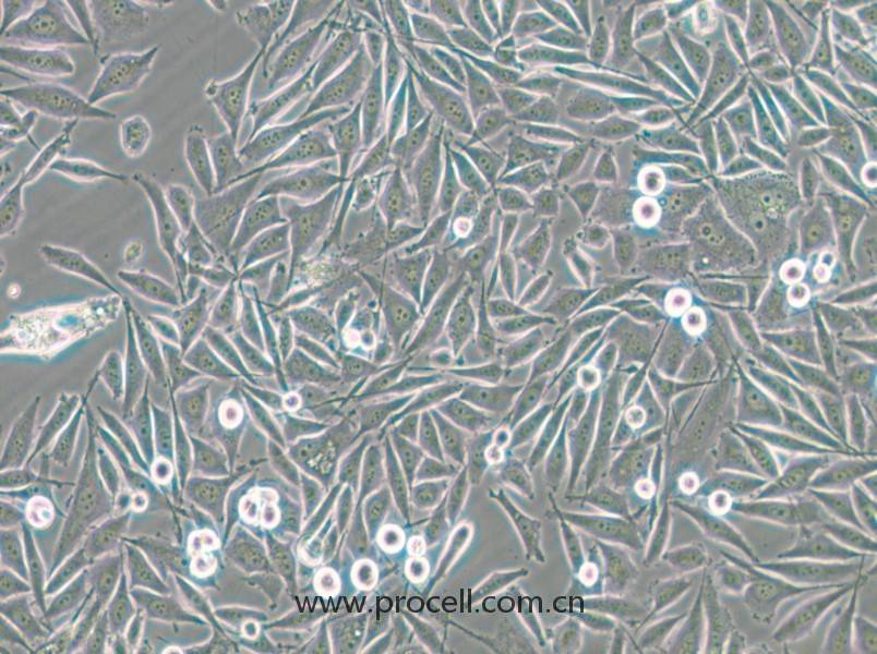 PC-3-GFP (人前列腺癌細(xì)胞（綠色熒光標(biāo)記）) (STR鑒定正確)