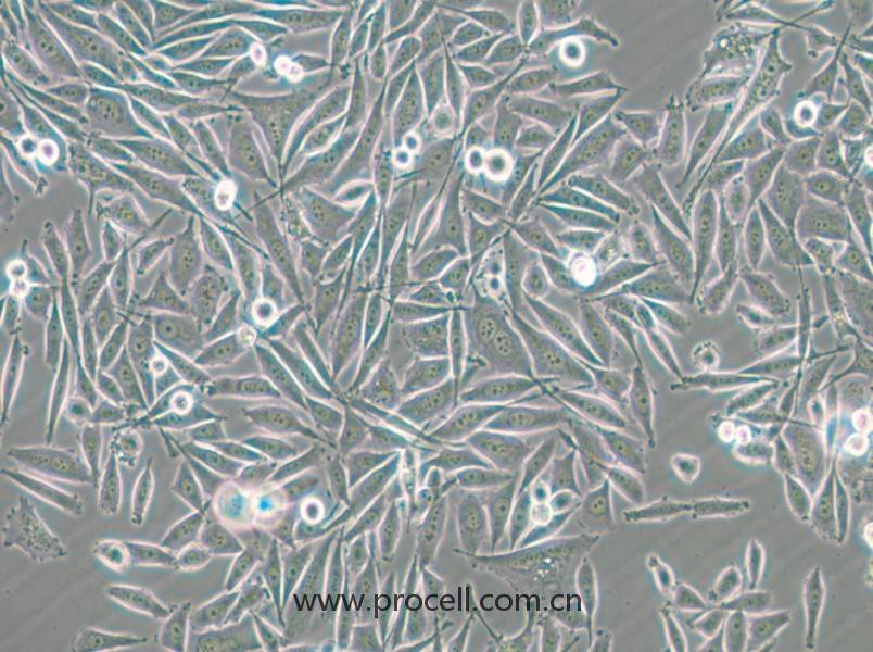 PC-3-GFP (人前列腺癌細(xì)胞（綠色熒光標(biāo)記）) (STR鑒定正確)