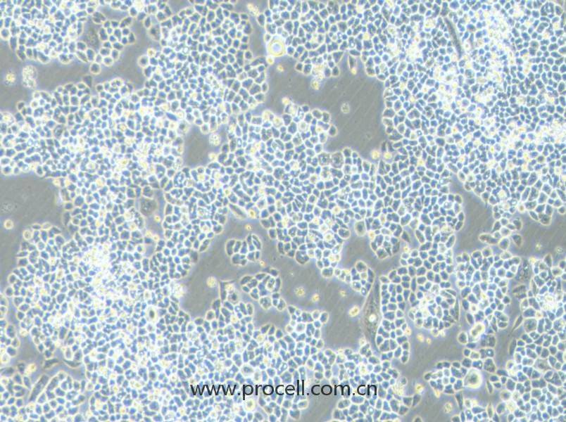 HCT-15-5FU (人結(jié)直腸癌氟尿嘧啶耐藥株) (STR鑒定正確)