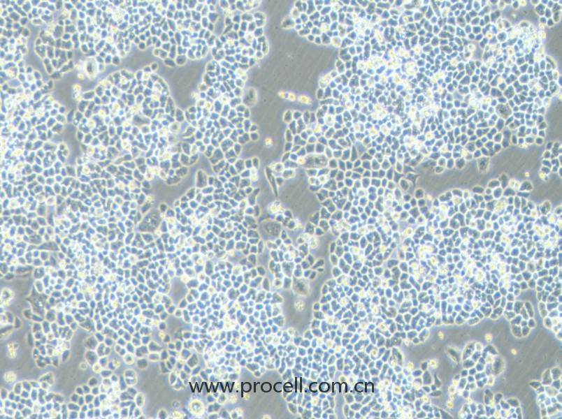 HCT-15-5FU (人結(jié)直腸癌氟尿嘧啶耐藥株) (STR鑒定正確)