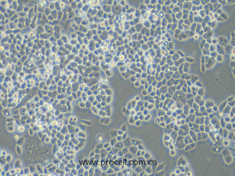 HCT-15-5FU (人結(jié)直腸癌氟尿嘧啶耐藥株) (STR鑒定正確)