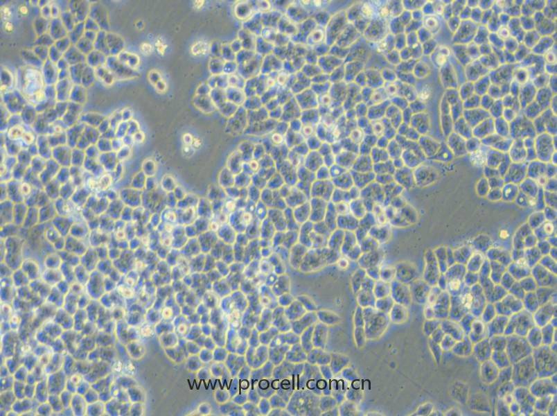 HCT-15-5FU (人結(jié)直腸癌氟尿嘧啶耐藥株) (STR鑒定正確)