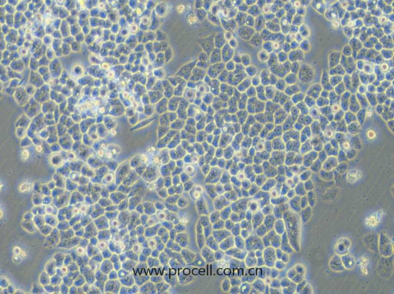 HCT-15-5FU (人結(jié)直腸癌氟尿嘧啶耐藥株) (STR鑒定正確)