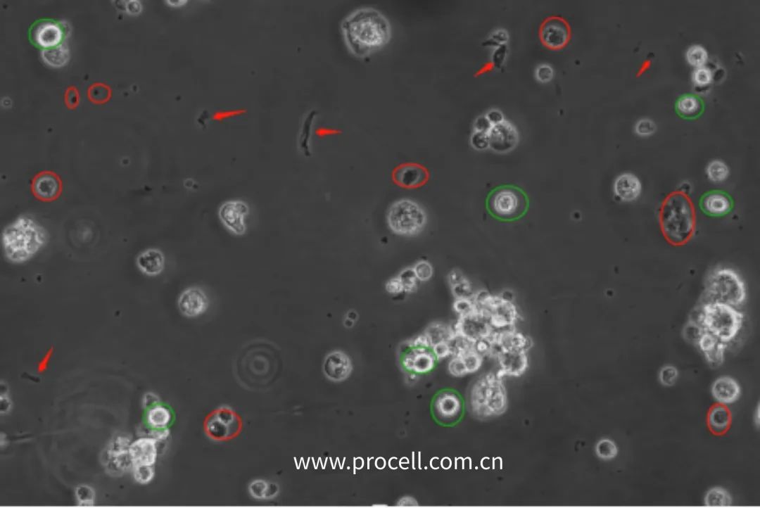 紅色圈為死細(xì)胞；綠色圈為活細(xì)胞；箭頭為血清雜質(zhì)